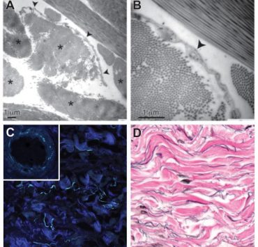 nolisoli care new organ interstitium
