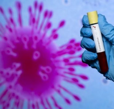 UPNIH testing kits for COVID-19 set to be used starting next week