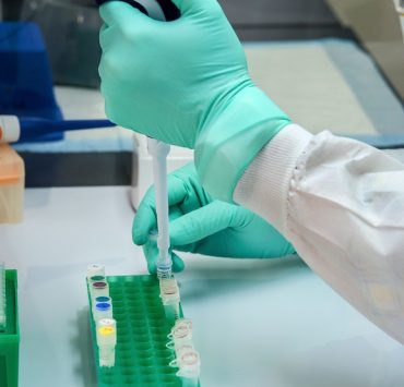 UPNIH testing kits for COVID-19 set to be used starting next week