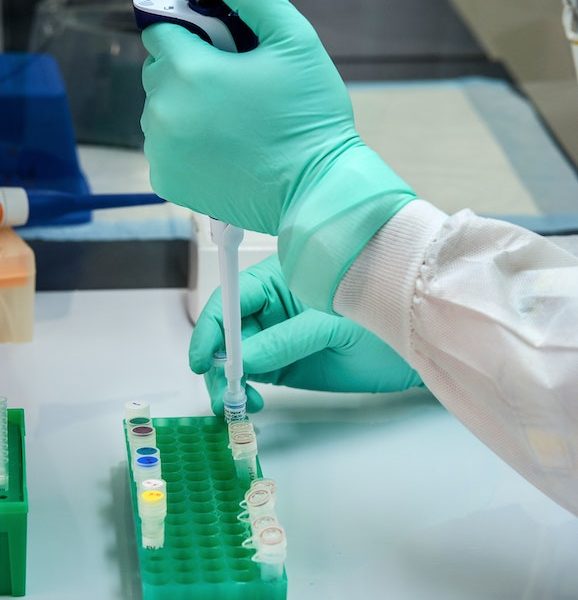 UPNIH testing kits for COVID-19 set to be used starting next week