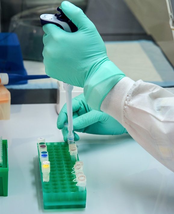 UPNIH testing kits for COVID-19 set to be used starting next week