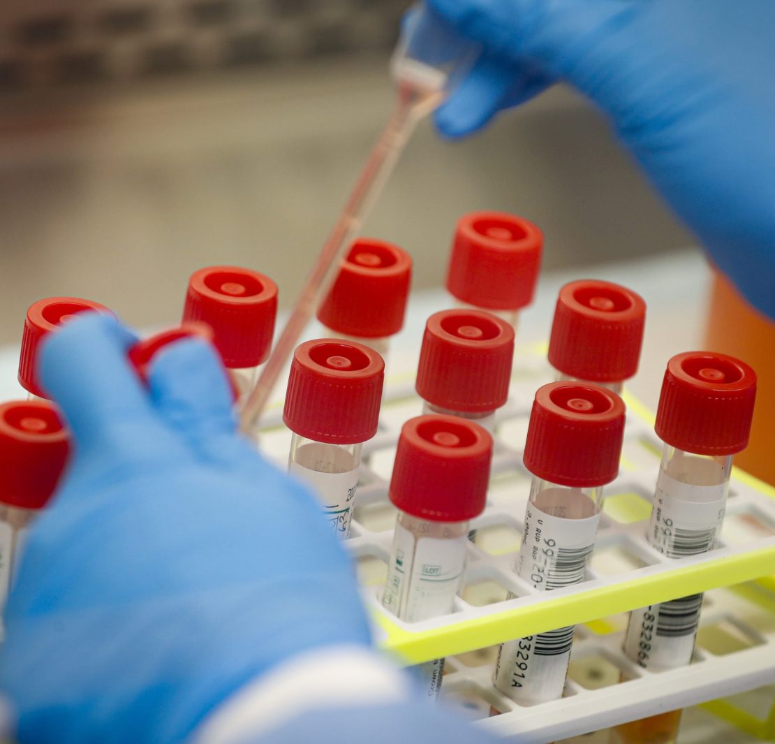 PH government aims to start mass testing for PUIs and PUMs on Apr. 14