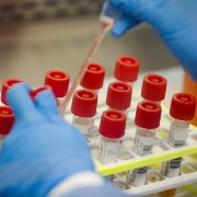 PH government aims to start mass testing for PUIs and PUMs on Apr. 14