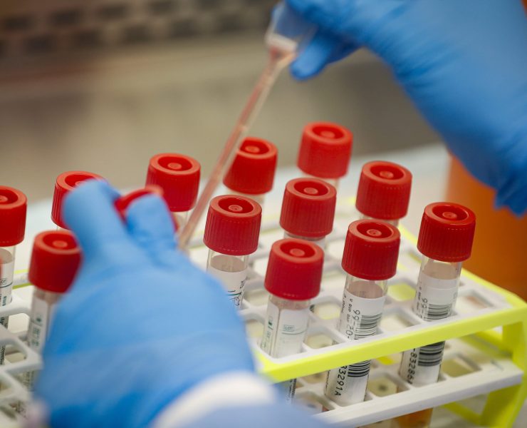 PH government aims to start mass testing for PUIs and PUMs on Apr. 14