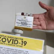 UP covid-19 test kit