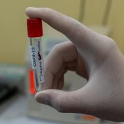 covid-19 test